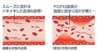 瘀血 どのくらい で 治る